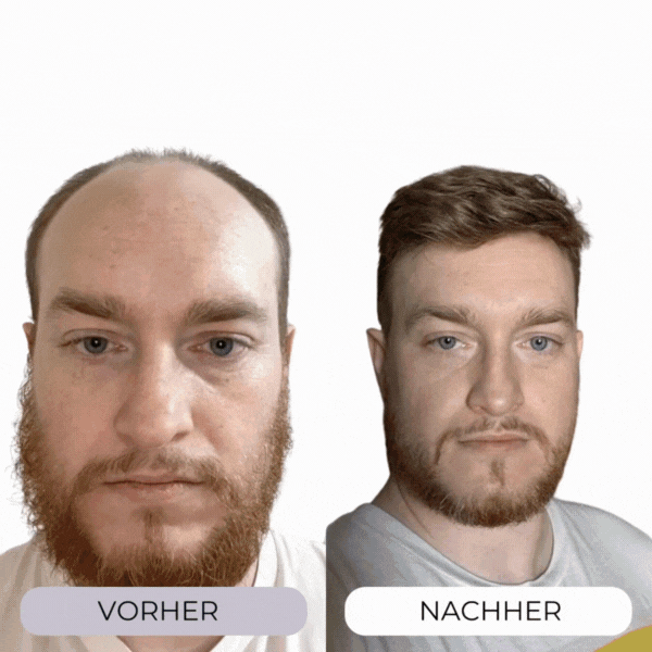 VitaCap Haarwuchskappe