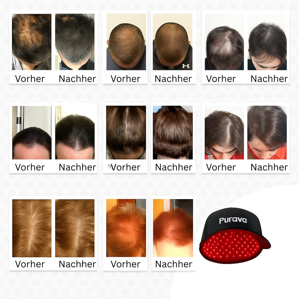 VitaCap Haarwuchskappe
